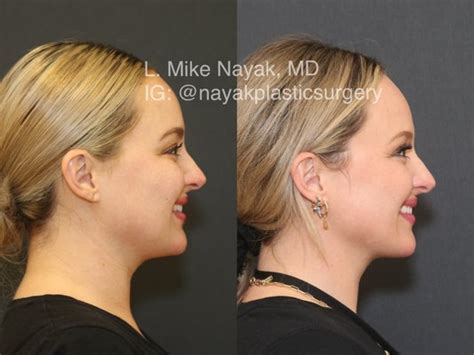 st louis cosmetic surgery spa|Nayak Plastic Surgery St. Louis Cosmetic Surgery.